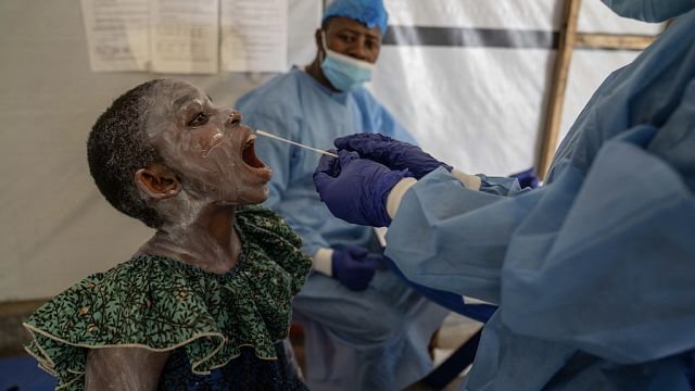 Mpox outbreak: DR Congo faces severe medicine shortages and overcrowding