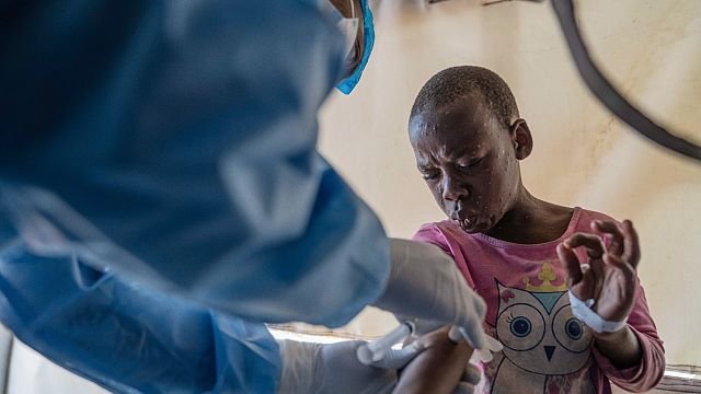 Mpox outbreak hits Kabare amid ongoing conflict in DRC