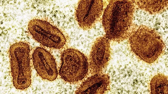 Mpox outbreak no longer a global health emergency, WHO chief says